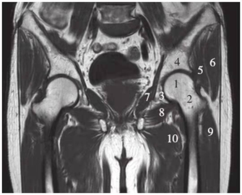 臀中肌;7.闭孔内肌;8.闭孔外肌;9.股外侧肌;10.