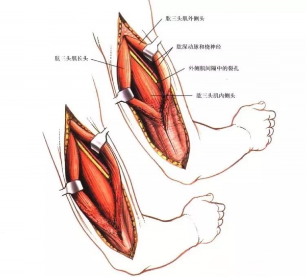 骨科手术肱骨进路歌诀