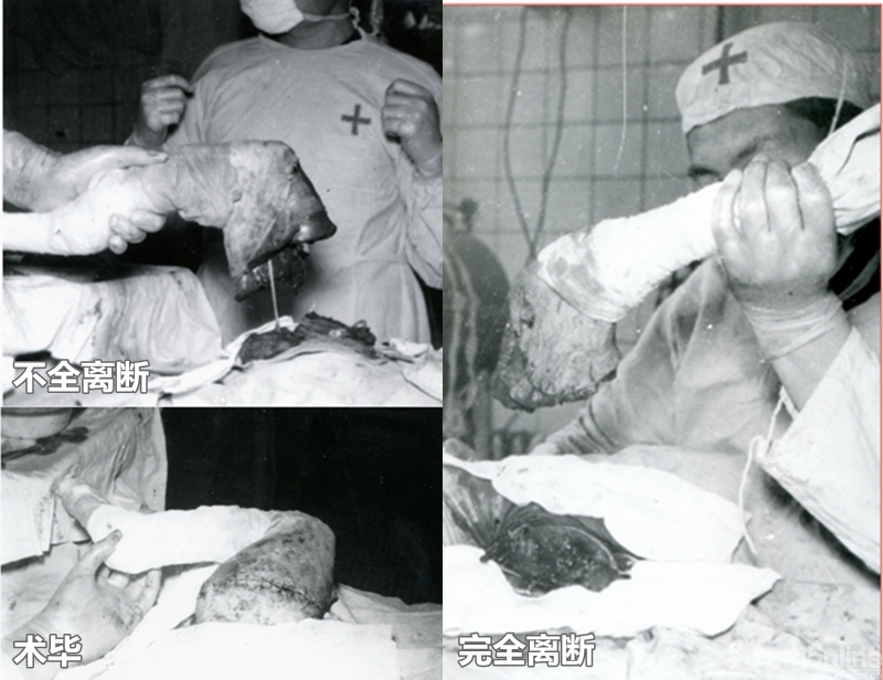 手术过程.jpg