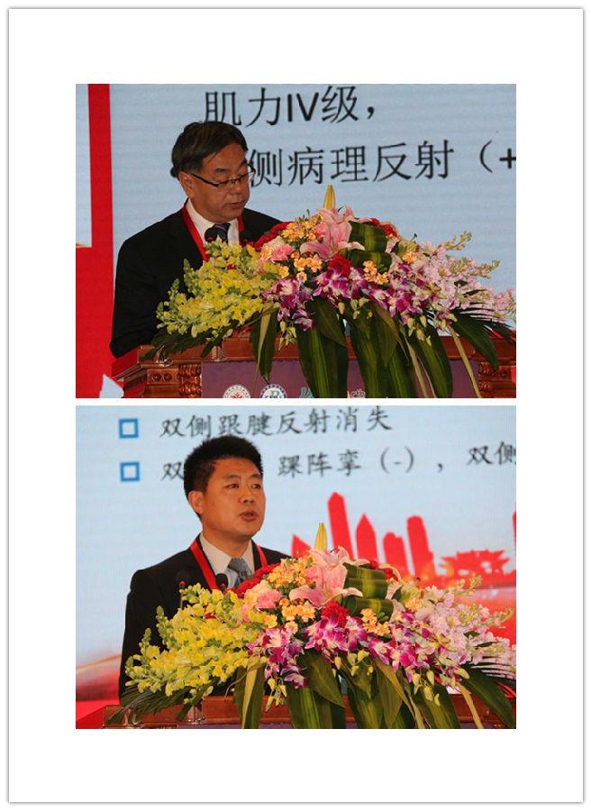 在腰椎侧弯专题部分,中国医科大学附属盛京医院的王欢教授和中国人民