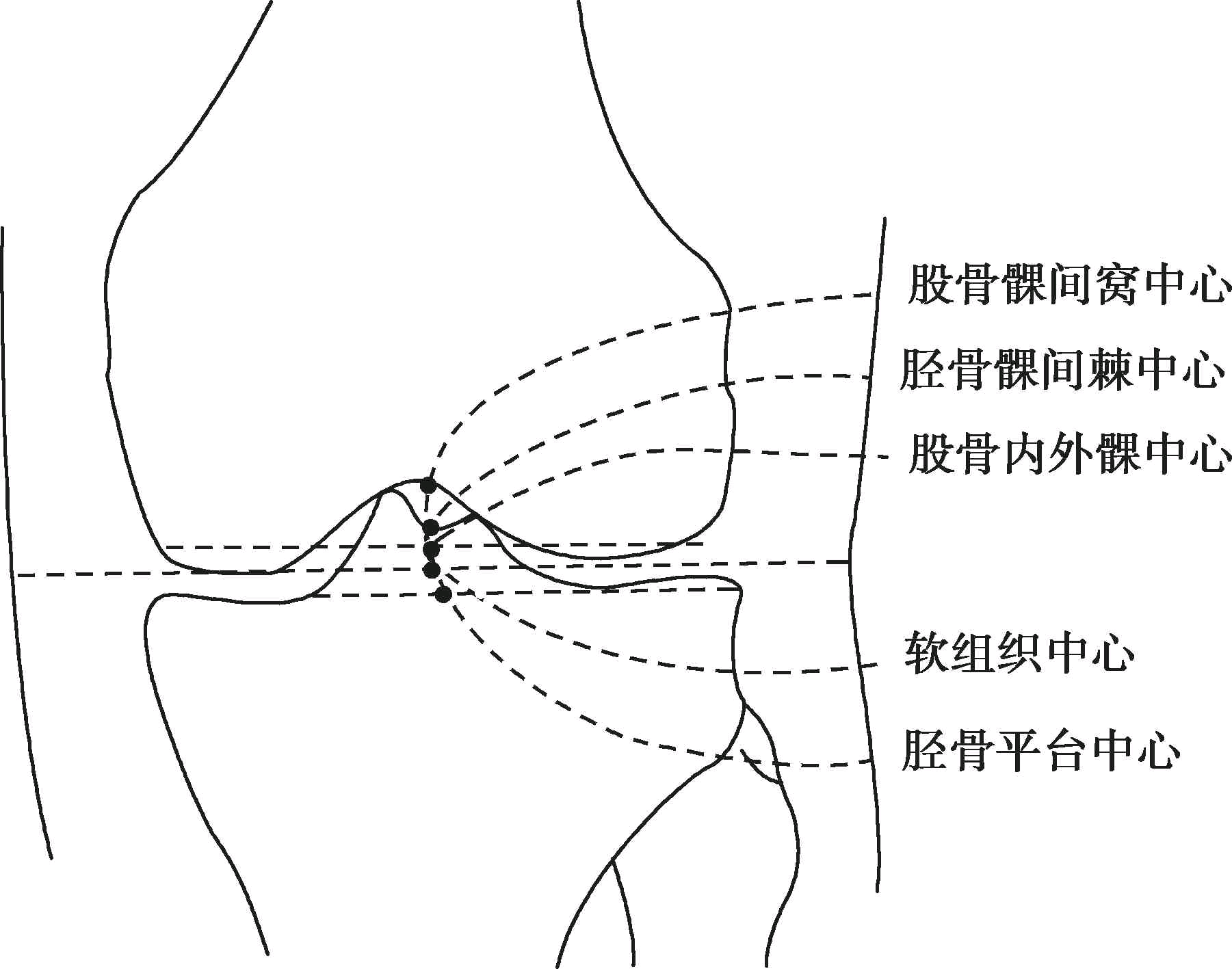 下肢力线测量方法图片图片